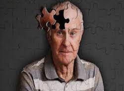Alzheimers sygdom